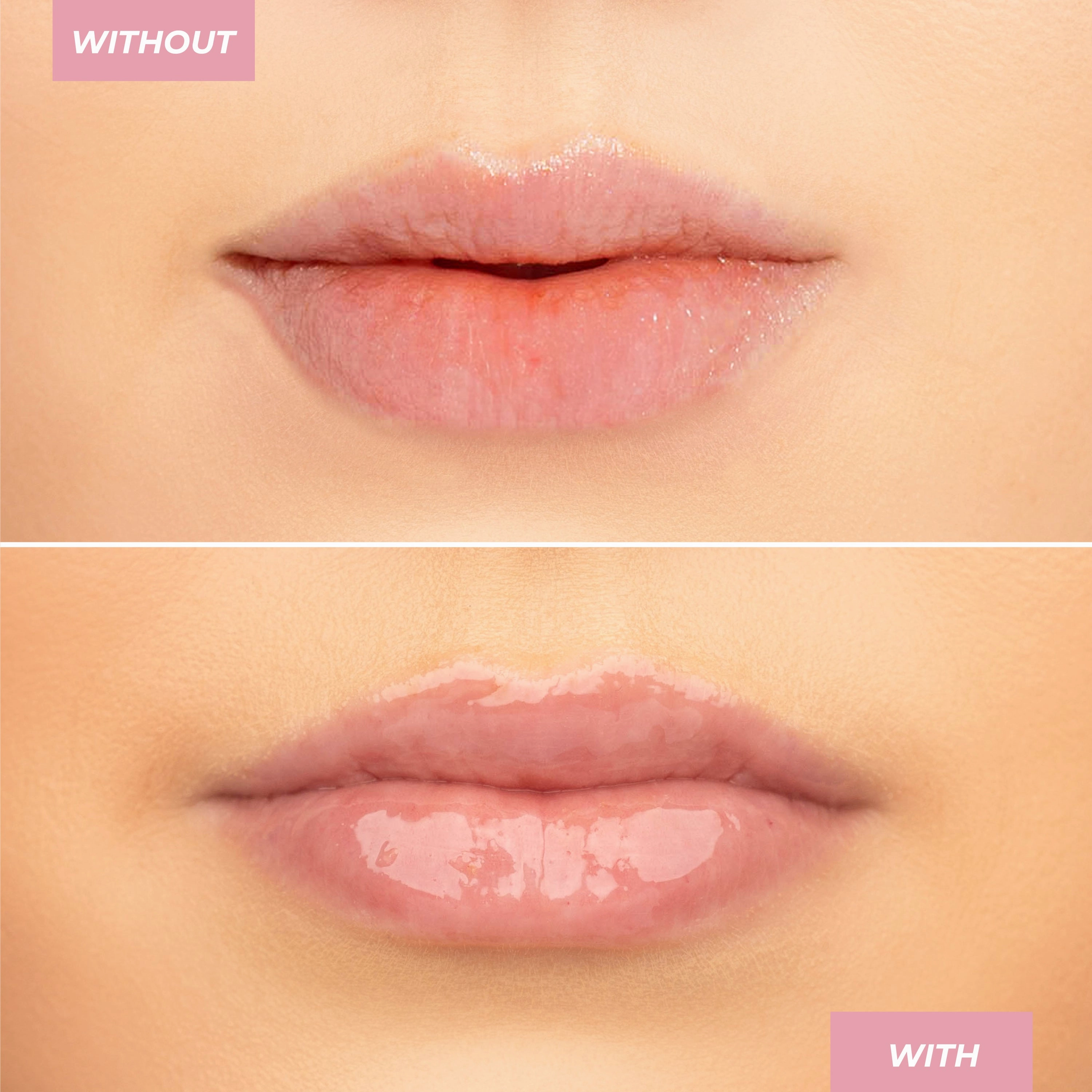 Peptide Lip Treatment