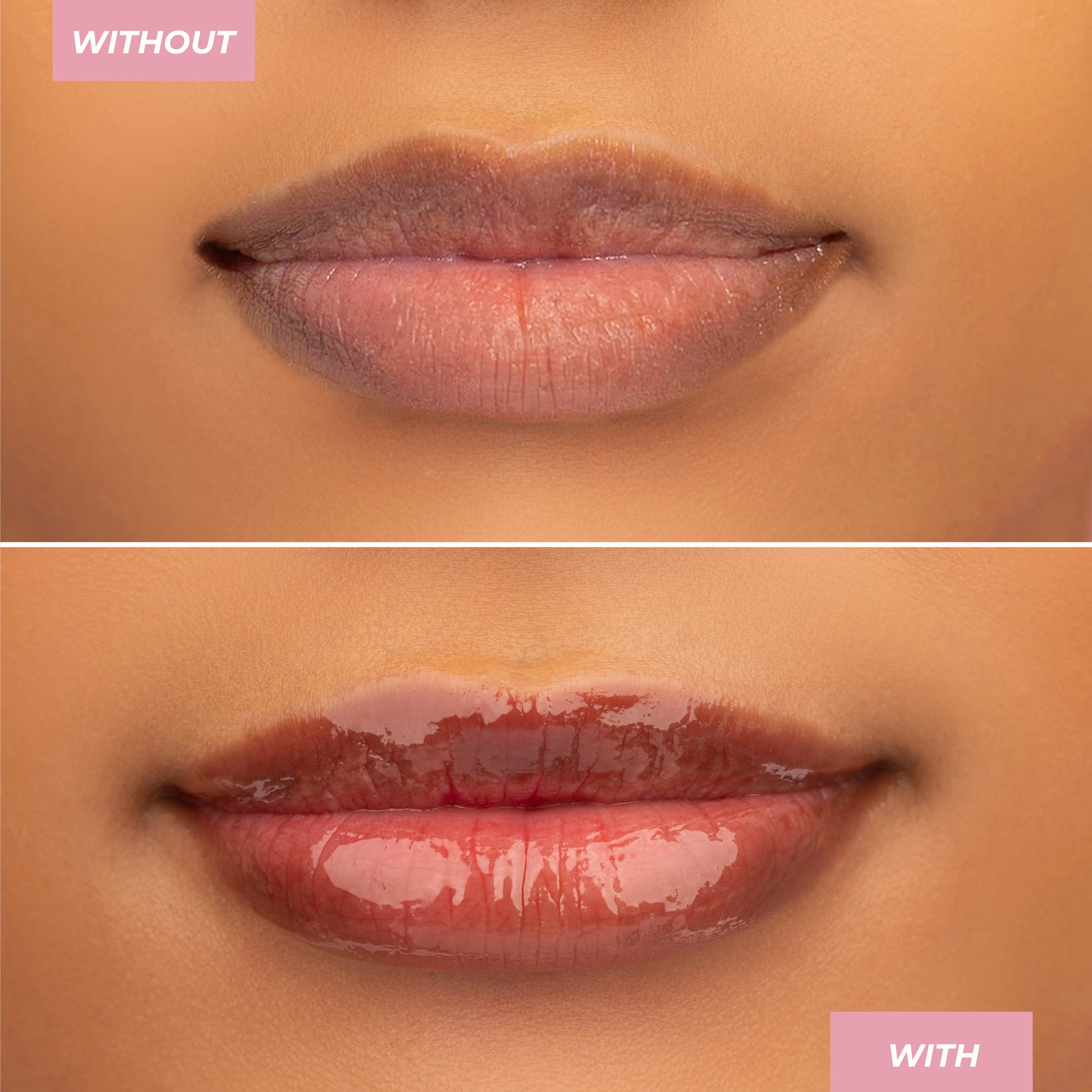 Peptide Lip Treatment