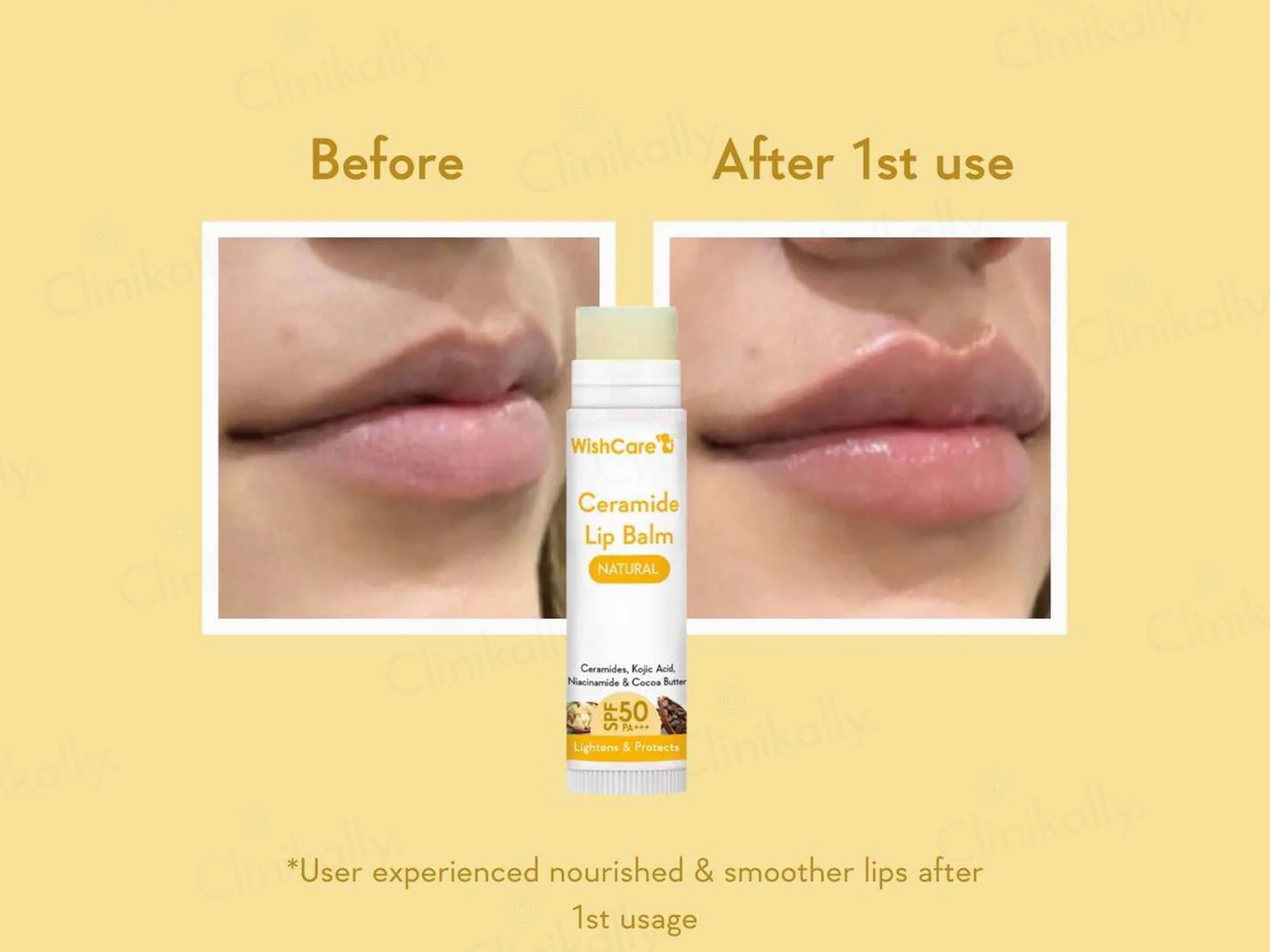 WishCare Ceramide Lip Balm - Natural SPF 50 PA   